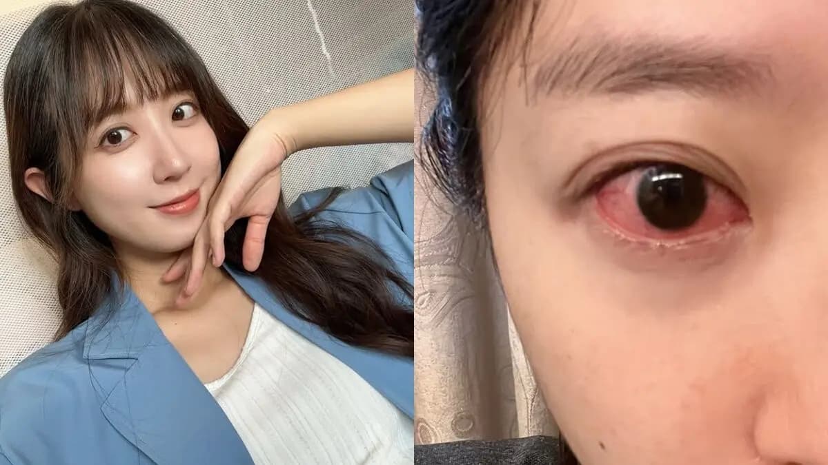 洪詩坐月子驚傳「角膜糜爛」! 眼睛劇紅近況曝光:真的要聽話