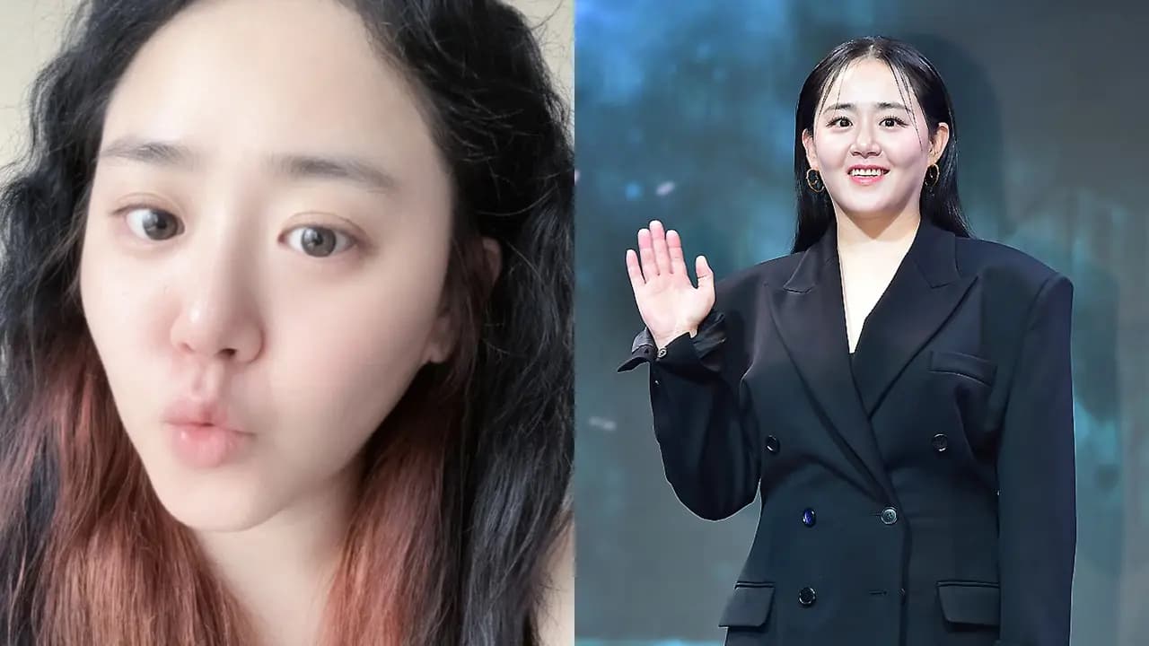 「國民妹妹」文瑾瑩罕病痊癒!7個月後驚人變化,素顏照美出新高度~