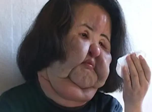 电风扇阿姨韩慧景生前照片与SBS节目画面