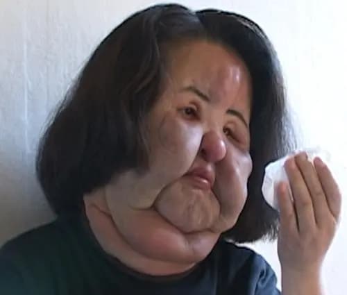 韩国电风扇阿姨韩慧景年轻时照片与毁容后对比