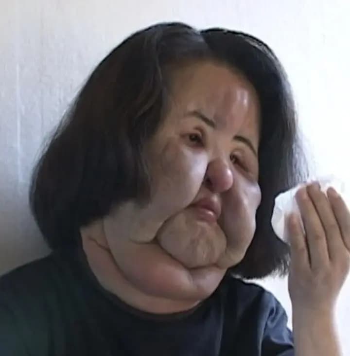 已故“电风扇阿姨”韩慧景生前照片与SBS节目画面